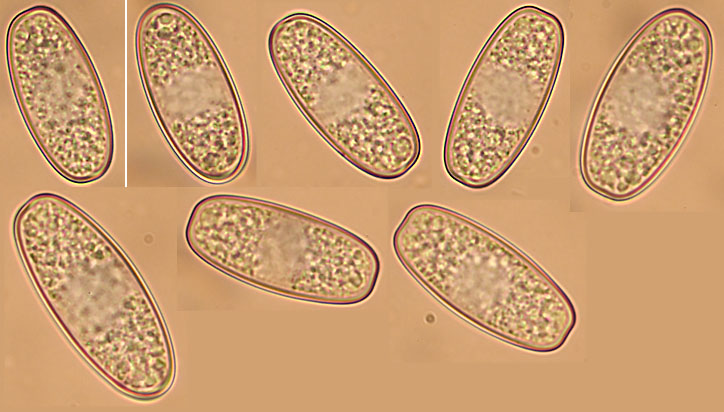Sarcoscypha austriaca